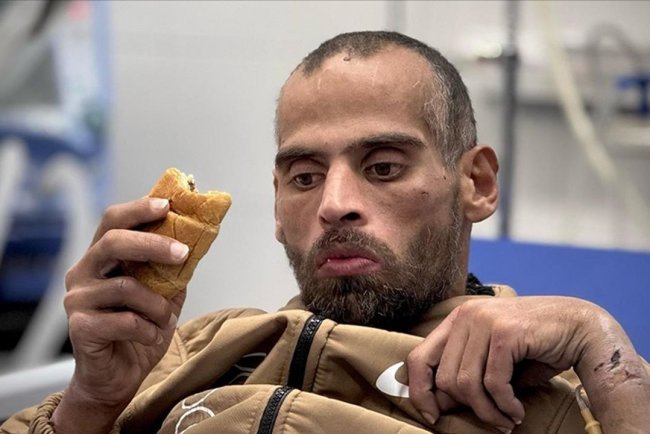 Salıverilen Filistinli, işkenceden konuşma ve hareket yetisini büyük ölçüde kaybetti