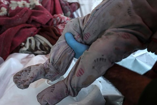 Gazze'deki Sağlık Bakanlığı: Yetersiz beslenme nedeniyle 52 çocuk şehit oldu, sayı daha da artabilir