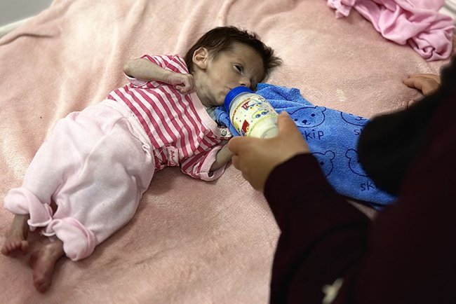 UNICEF: Haziran ayında Gazze’de 5800 çocuğa yetersiz beslenme teşhisi konuldu