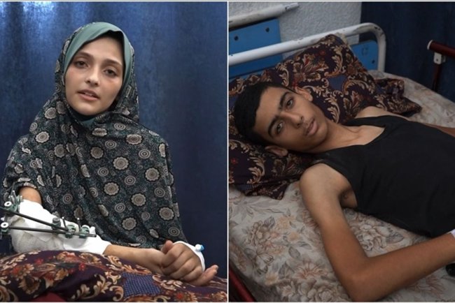 Gazzeli 2 kardeş, yetersiz beslenme nedeniyle iyileşemiyor