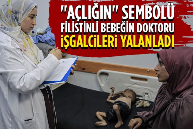 Gazze'de "açlığın" sembolü Filistinli bebeğin doktoru işgalcileri yalanladı