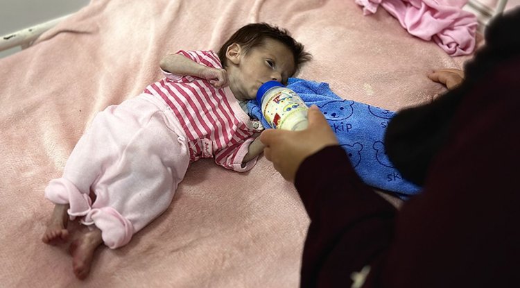 UNICEF: Haziran ayında Gazze’de 5800 çocuğa yetersiz beslenme teşhisi konuldu