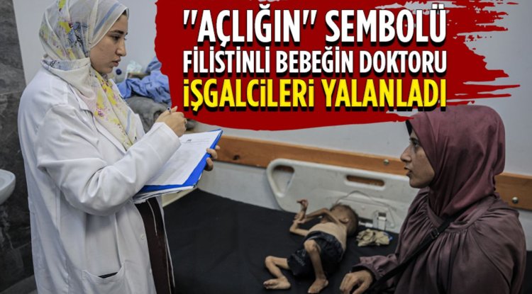 Gazze'de "açlığın" sembolü Filistinli bebeğin doktoru işgalcileri yalanladı