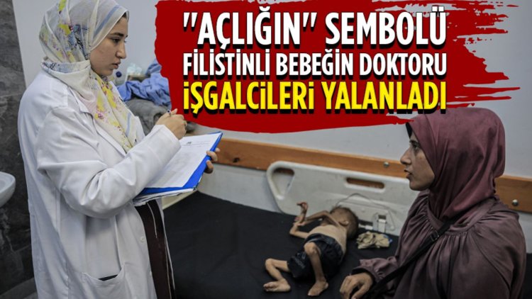 Gazze'de "açlığın" sembolü Filistinli bebeğin doktoru işgalcileri yalanladı