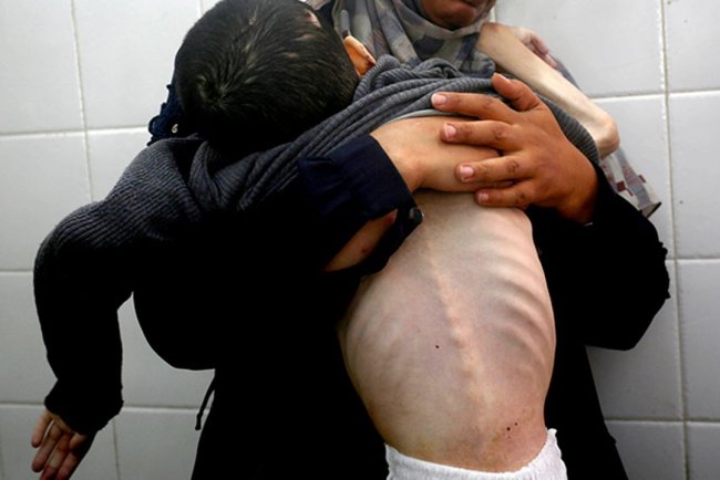 Filistinli Tamir Şuhaybir açlıktan şehit oldu