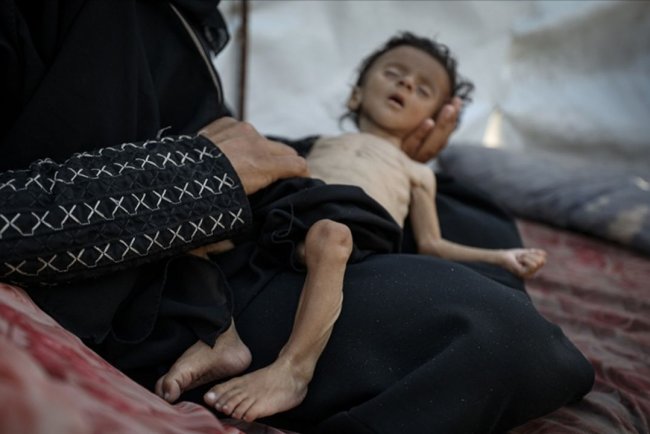 İşgalcilerin kıtlığı dayattığı Gazze'de son 24 saatte 11 kişi daha açlıktan şehit oldu