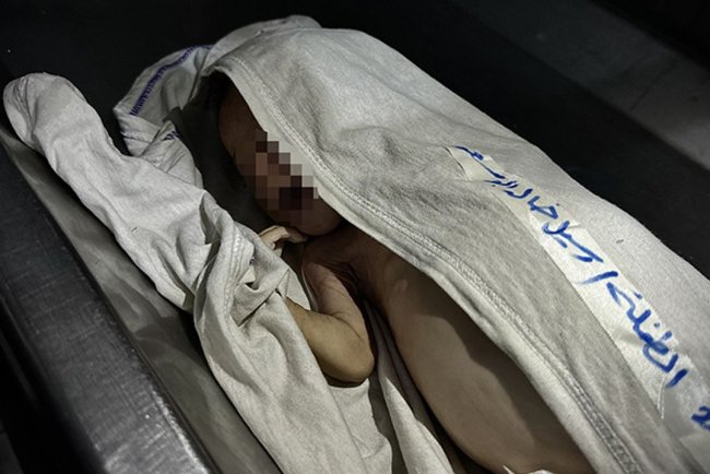 Gazze Şeridi'nde 2 aylık Rasil bebek yetersiz beslenme nedeniyle şehit oldu