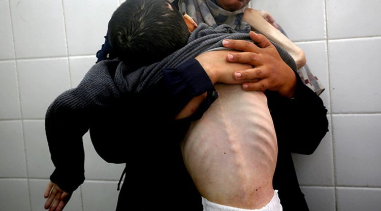 Filistinli Tamir Şuhaybir açlıktan şehit oldu