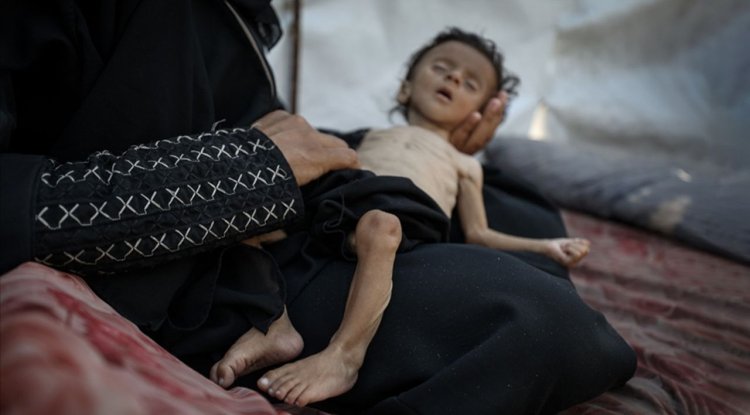 İşgalcilerin kıtlığı dayattığı Gazze'de son 24 saatte 11 kişi daha açlıktan şehit oldu