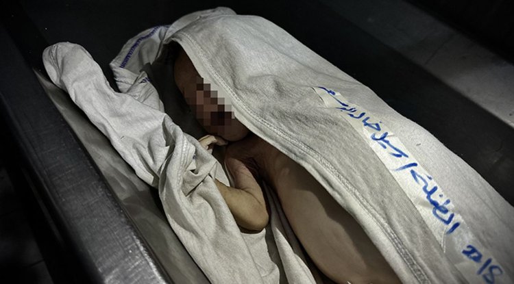 Gazze Şeridi'nde 2 aylık Rasil bebek yetersiz beslenme nedeniyle şehit oldu
