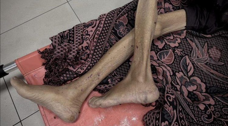 İşgalcilerin kıtlığı dayattığı Gazze'de son 24 saatte 3'ü çocuk 10 kişi daha açlıktan şehit oldu