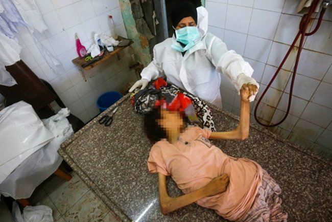 İşgalcilerin kıtlığı dayattığı Gazze'de son 24 saatte 7 kişi daha açlıktan şehit oldu