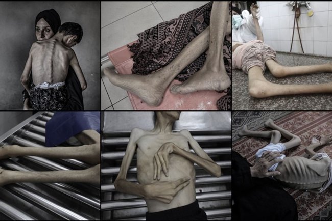 İşgalcilerin kıtlığı dayattığı Gazze'de ağustos ayında 185 kişi açlıktan şehit oldu