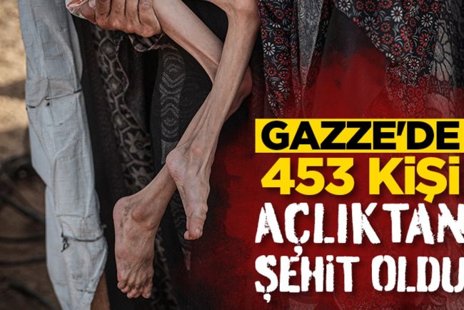 İşgalcilerin kıtlığı dayattığı Gazze'de 453 kişi açlıktan şehit oldu