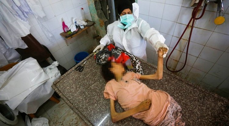 İşgalcilerin kıtlığı dayattığı Gazze'de son 24 saatte 7 kişi daha açlıktan şehit oldu