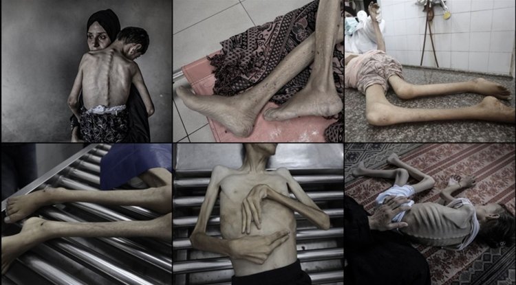 İşgalcilerin kıtlığı dayattığı Gazze'de ağustos ayında 185 kişi açlıktan şehit oldu