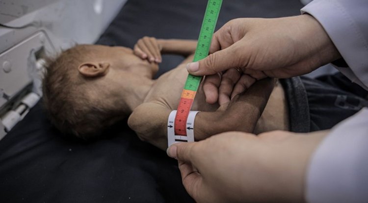 İşgalcilerin kıtlığı dayattığı Gazze'de son 24 saatte 1'i çocuk 6 kişi daha açlıktan şehit oldu