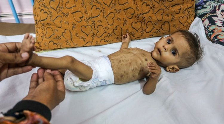 İşgalcilerin kıtlığı dayattığı Gazze'de son 24 saatte 2'si çocuk 6 kişi daha açlıktan şehit oldu