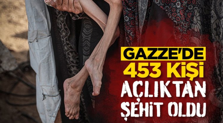 İşgalcilerin kıtlığı dayattığı Gazze'de 453 kişi açlıktan şehit oldu