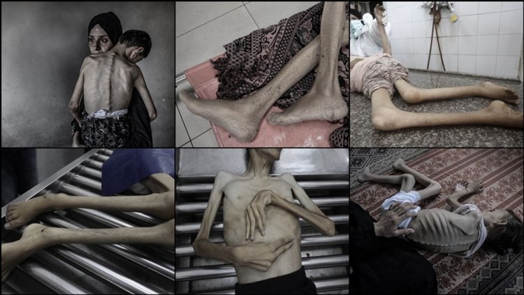 İşgalcilerin kıtlığı dayattığı Gazze'de ağustos ayında 185 kişi açlıktan şehit oldu