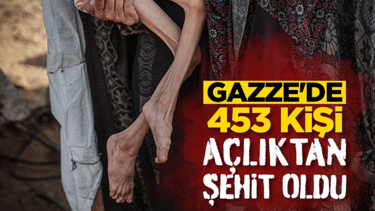 İşgalcilerin kıtlığı dayattığı Gazze'de 453 kişi açlıktan şehit oldu